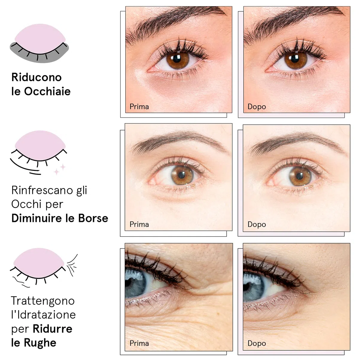 Patch Occhi Premiati (24 Paia, Rosa) – Premio Migliori Patch Occhiaie e Borse Naturali – Riduce Occhiaie, Gonfiori, Borse e Rughe – Maschera Occhi Vegan – Eye Patch by grace&stella