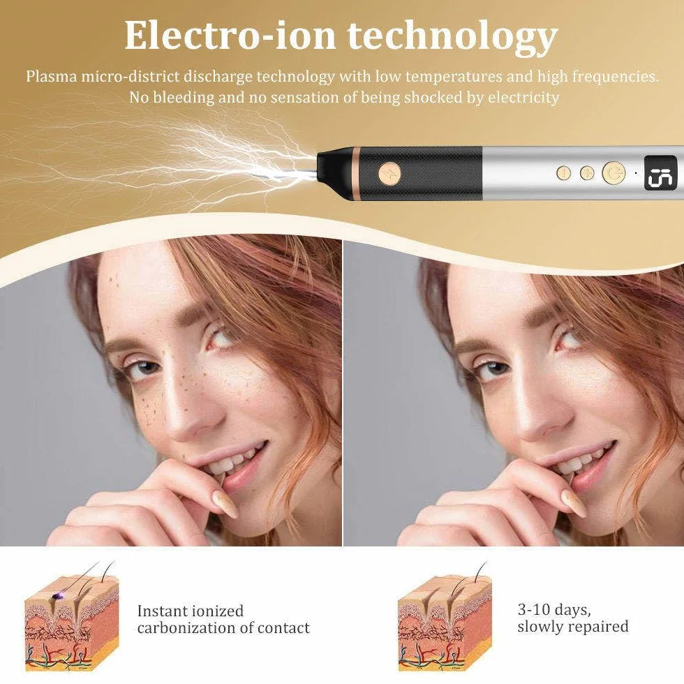 Penna Laser al Plasma a 15 Livelli, Penna per La Rimozione di Verruche, nei, Macchie, Lentiggini, nei, per Labbra, Mani, Occhi, Viso, Testa, Naso, Sicura E Indolore, Non Danneggia La Pelle