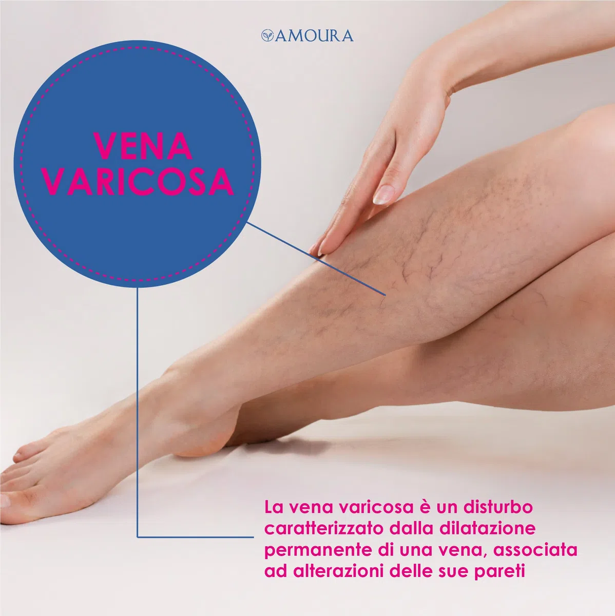 Amoura Crema Vene Varicose e Capillari - 100 ml - Crema Gambe Stanche e Pesanti - Made in Italy