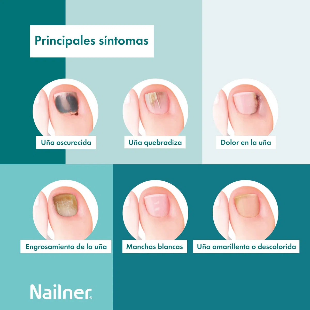 Nailner Lápiz 2 En 1, articolo multifunzione per la vita di ogni giorno, adatto a chi vuole semplificare la propria routine, flacone da 4 ml adatto a chi cerca soluzioni pratiche senza rinunciare al c