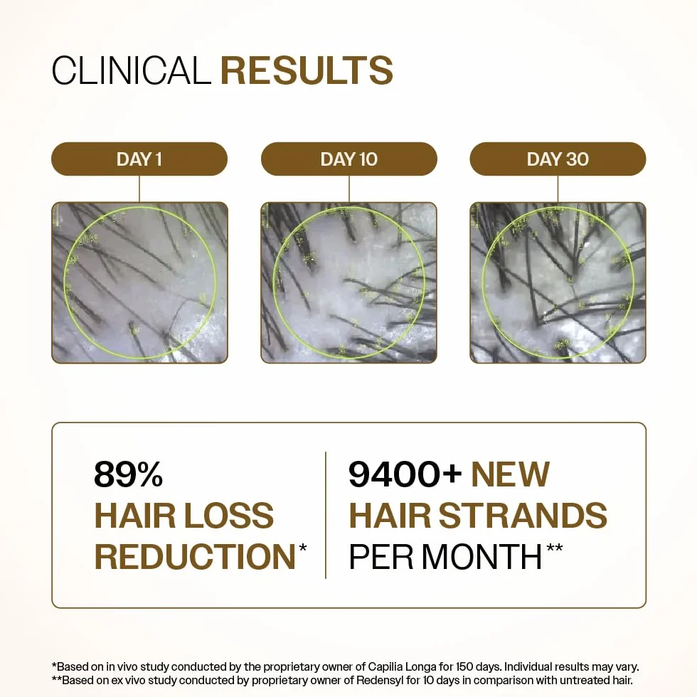 Bare Anatomy Siero avanzato per la crescita dei capelli 3% Redensyl + 4% Anagain + 3% Baicapil Rosmarino, biotina Siero per il controllo della