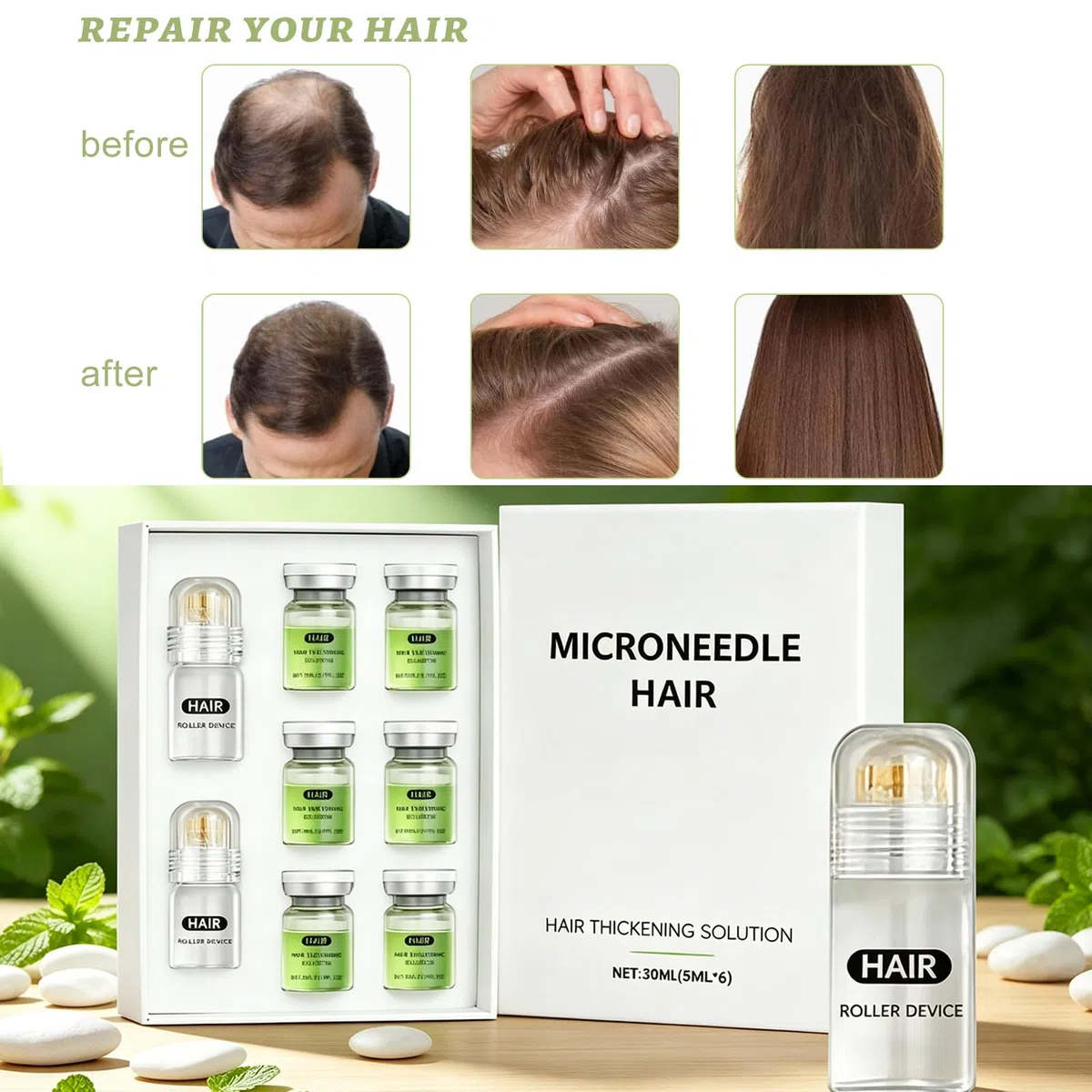 Microneedling, sistema di ricrescita dei capelli, Alpha Infuse Hair Growth Serum per rafforzare le radici dei capelli, favorisce la crescita dei capelli per la perdita di capelli, rinforza i capelli