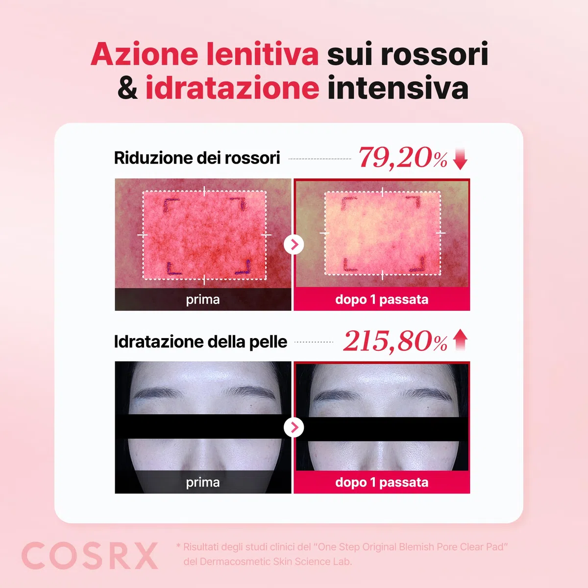 COSRX OneStep Original Blemish Pore Clear Pad, 100 cialde, Dual side Face Pad for Exfoliation, Pore Care & Idration with BHA, PHA & Zinc PCA & 5 Acidi ialuronici, coreano Skin Care