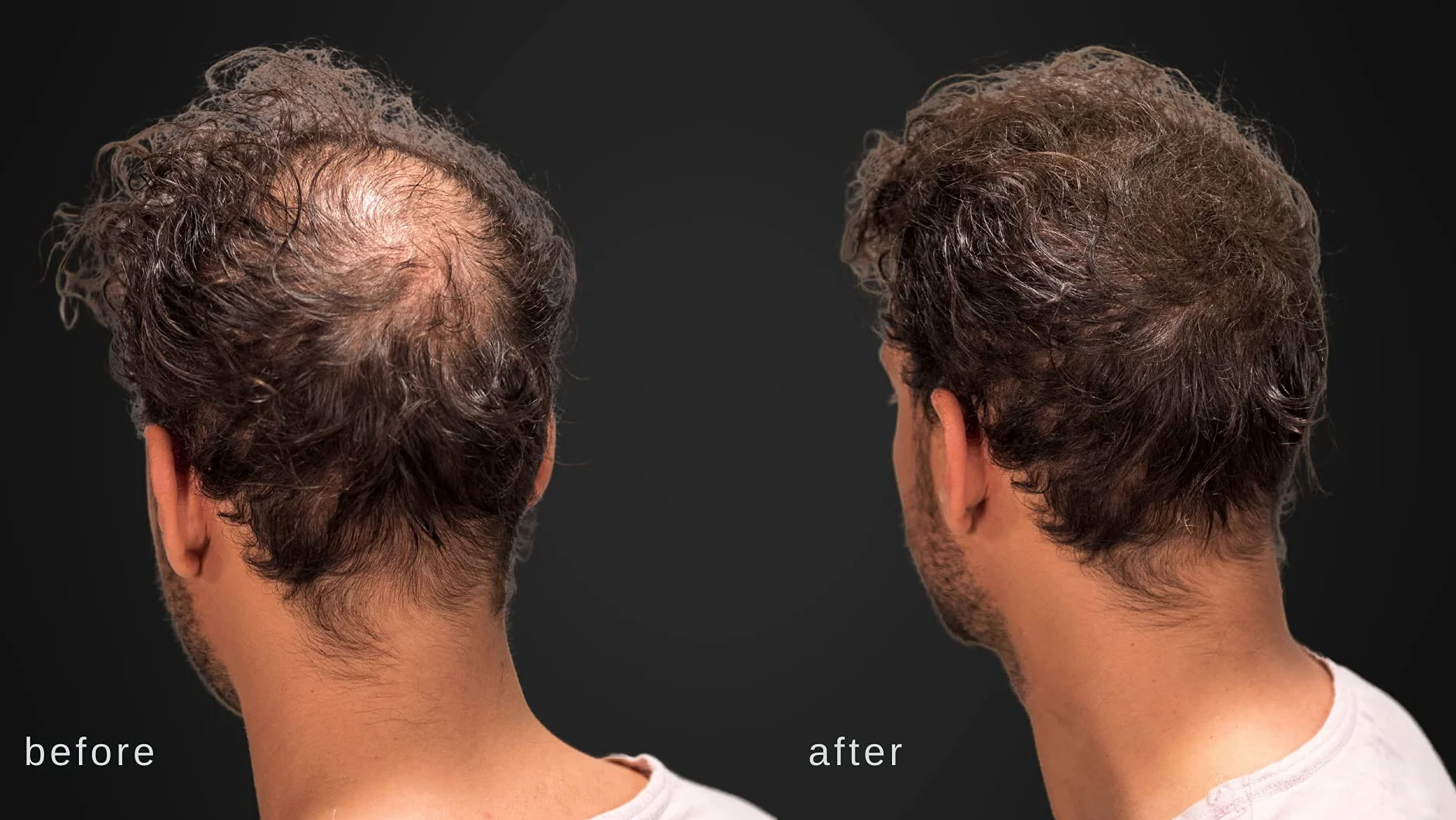 Volumizzante fibre dei capelli con vera cheratina per diradamento dei capelli/perdita di capelli - 60 giorni + fornitura - Risultati massimi istantaneamente - (Grigio)