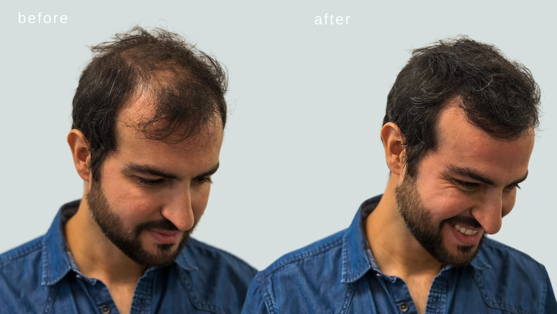 Volumizzante fibre dei capelli con vera cheratina per diradamento dei capelli/perdita di capelli - 60 giorni + fornitura - Risultati massimi istantaneamente - (Grigio)