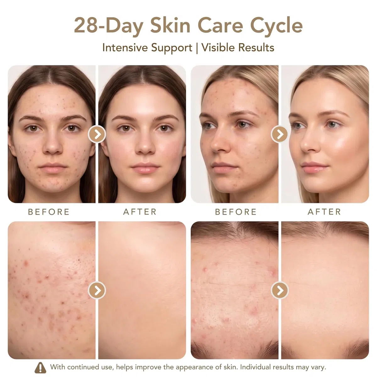 Dr. Pen Cartucce 12 Pin, 15 Pezzi, Cartucce di Ricambio per Penna Microneedling, per la Cura Mirata della Pelle, Compatibili con M8S/A8S/A9