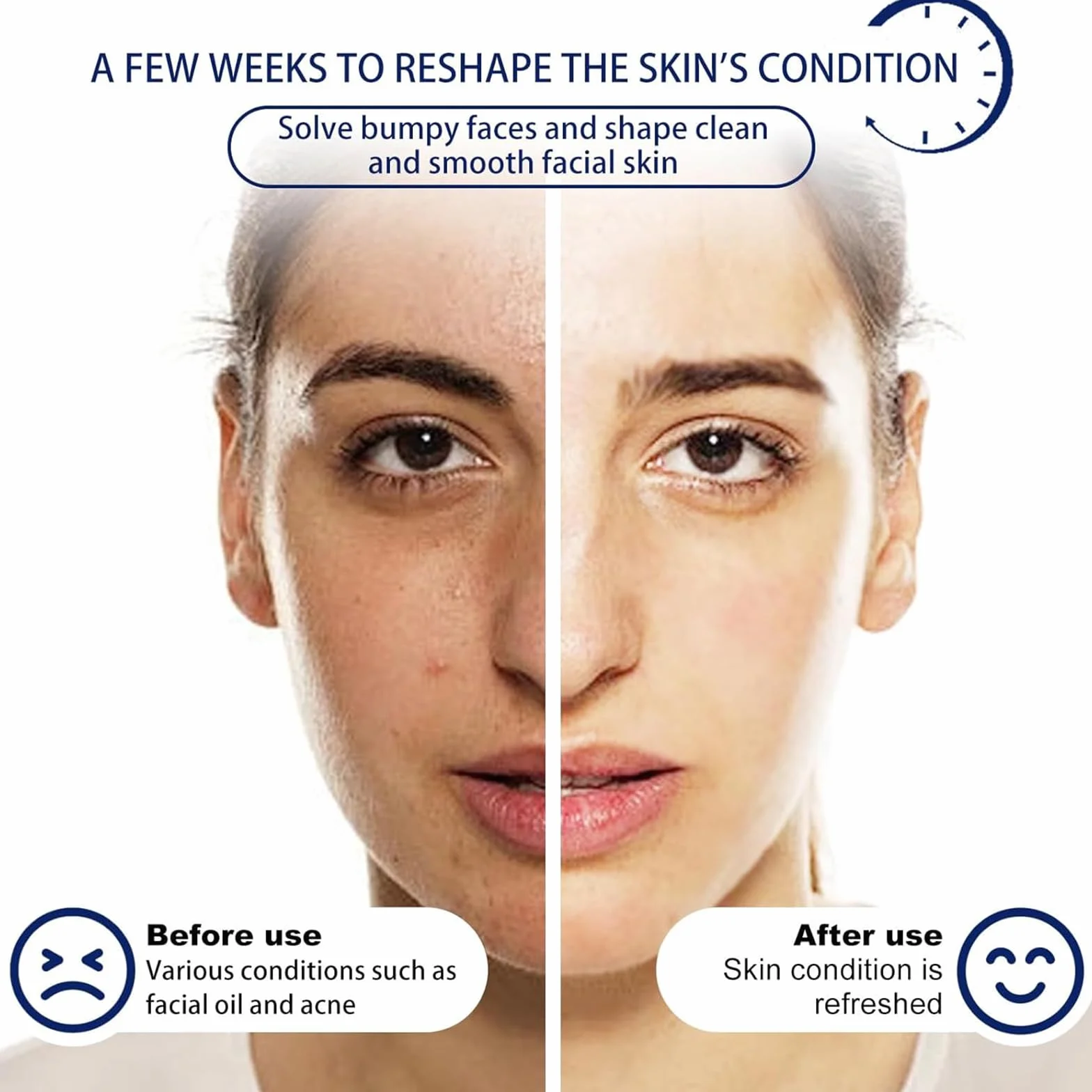 Acne Foaming Wash, Lozione detergente viso e corpo,Schiuma detergente per acne,Detergente viso morbido per la pulizia dei pori profondi