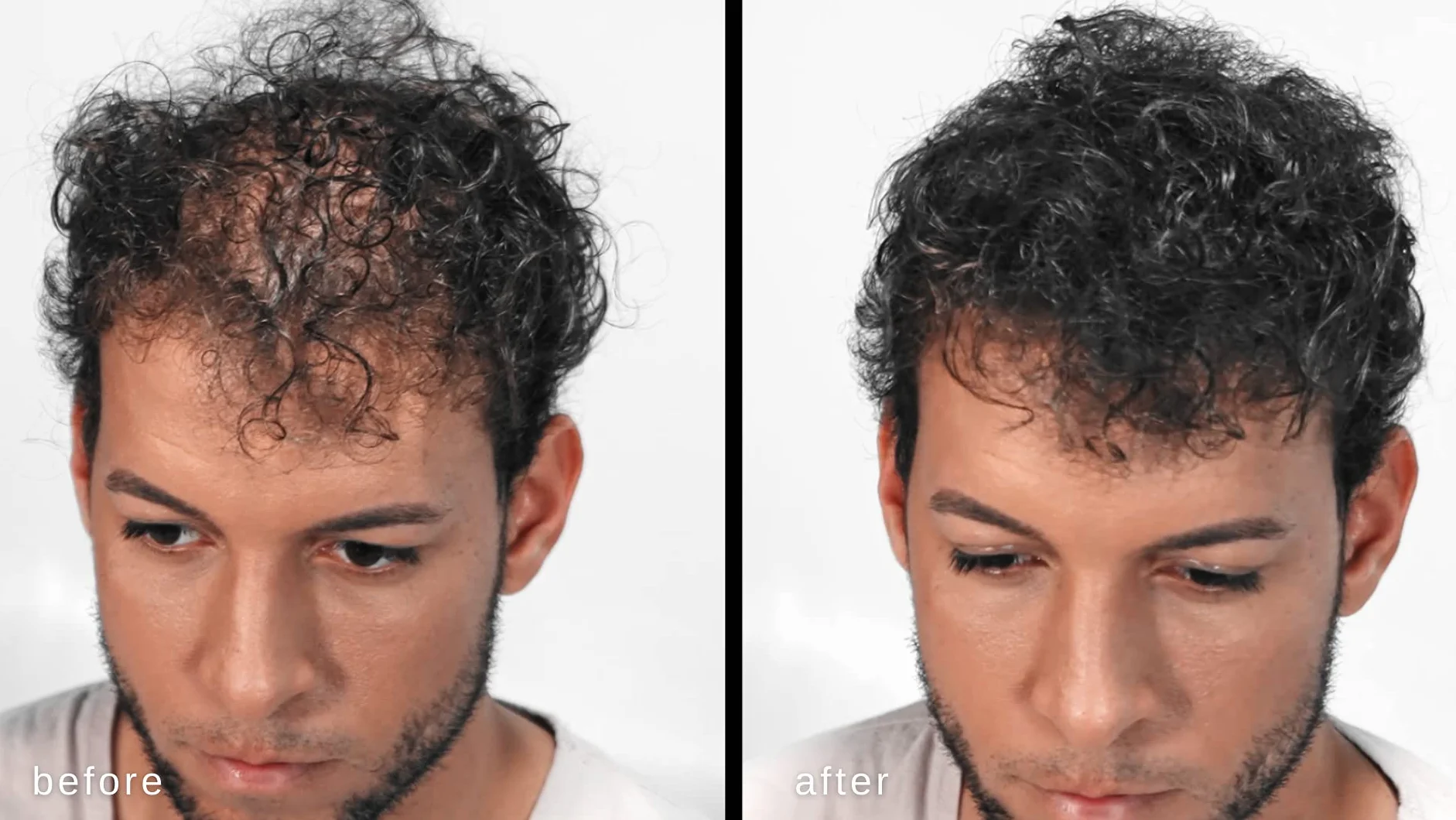 Volumizzante fibre dei capelli con vera cheratina per diradamento dei capelli/perdita di capelli - 60 giorni + fornitura - Risultati massimi istantaneamente - (Grigio)