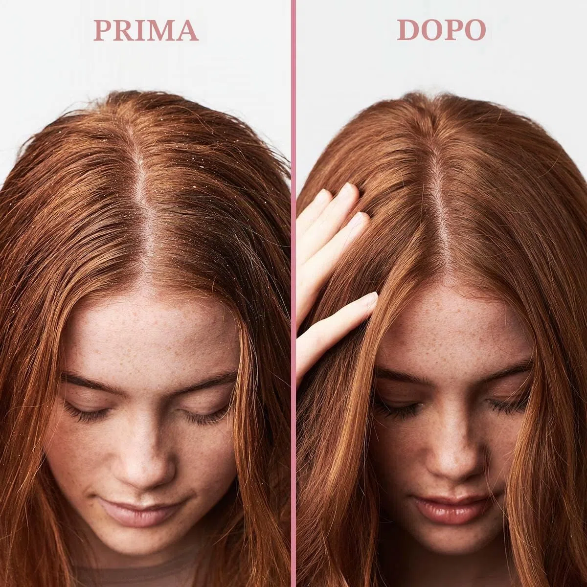 Umberto Giannini Scalp Scrub - Scrub rigenerante esfoliante antiforfora per cuoio capelluto, vegano e non testato sugli animali