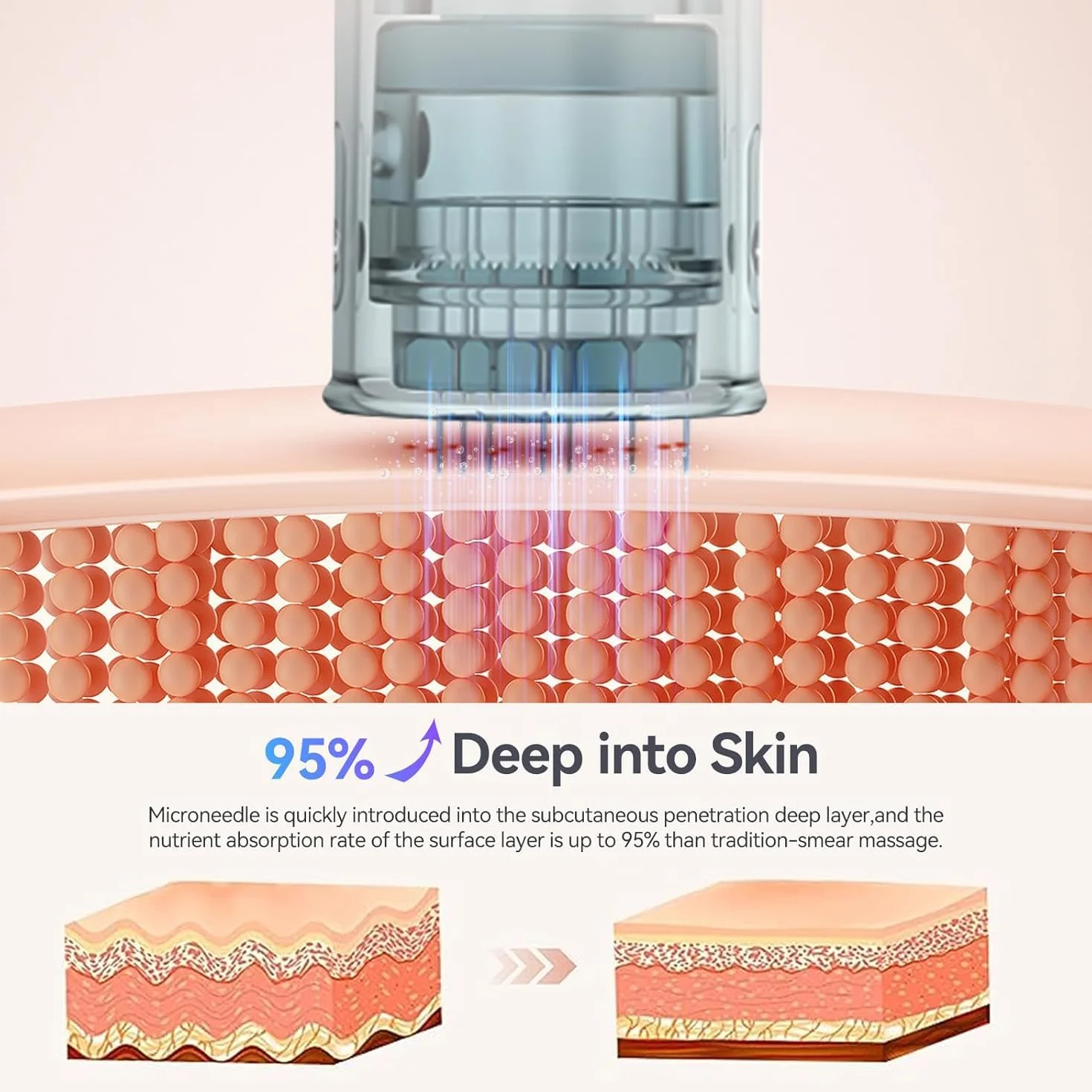 20PCS Dermapen Ultima M8 Microneedling Pen 16 Pins Cartucce di Ricambio Smaltimento Microneedling Viso Cartucce per Penna Microneedling