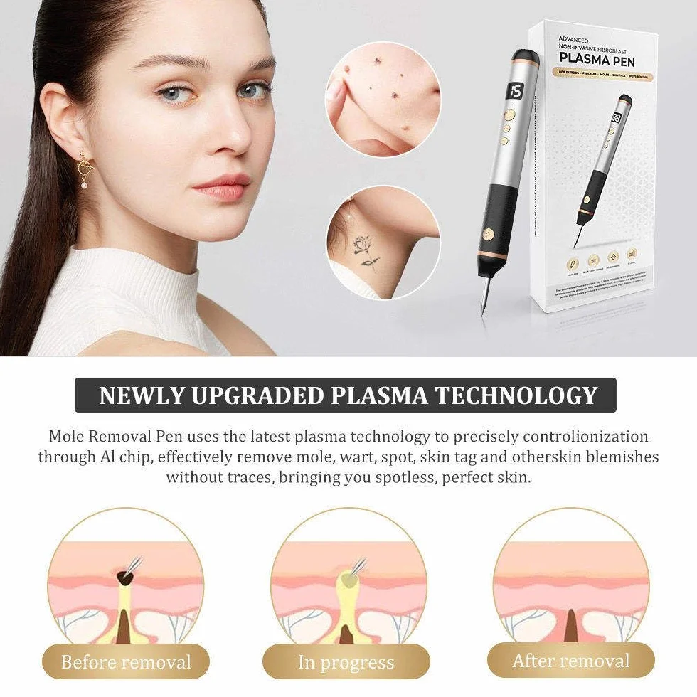 Penna Laser al Plasma a 15 Livelli, Penna per La Rimozione di Verruche, nei, Macchie, Lentiggini, nei, per Labbra, Mani, Occhi, Viso, Testa, Naso, Sicura E Indolore, Non Danneggia La Pelle