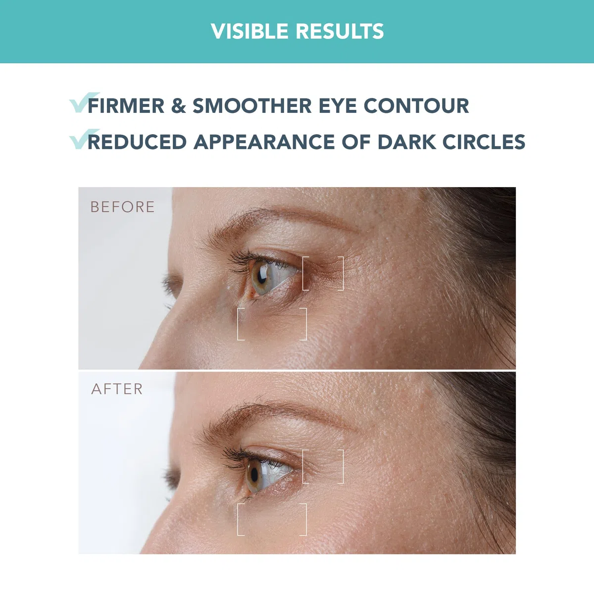 IRIS Siero Notte Rassodante per Contorno Occhi - Retinol - Estratto di funghi - Vitamina E - Bakuchiol - Siero Contorno Occhi - Contorno Occhi Occhiaie - Revitalift Contorno Occhi - 15 ml