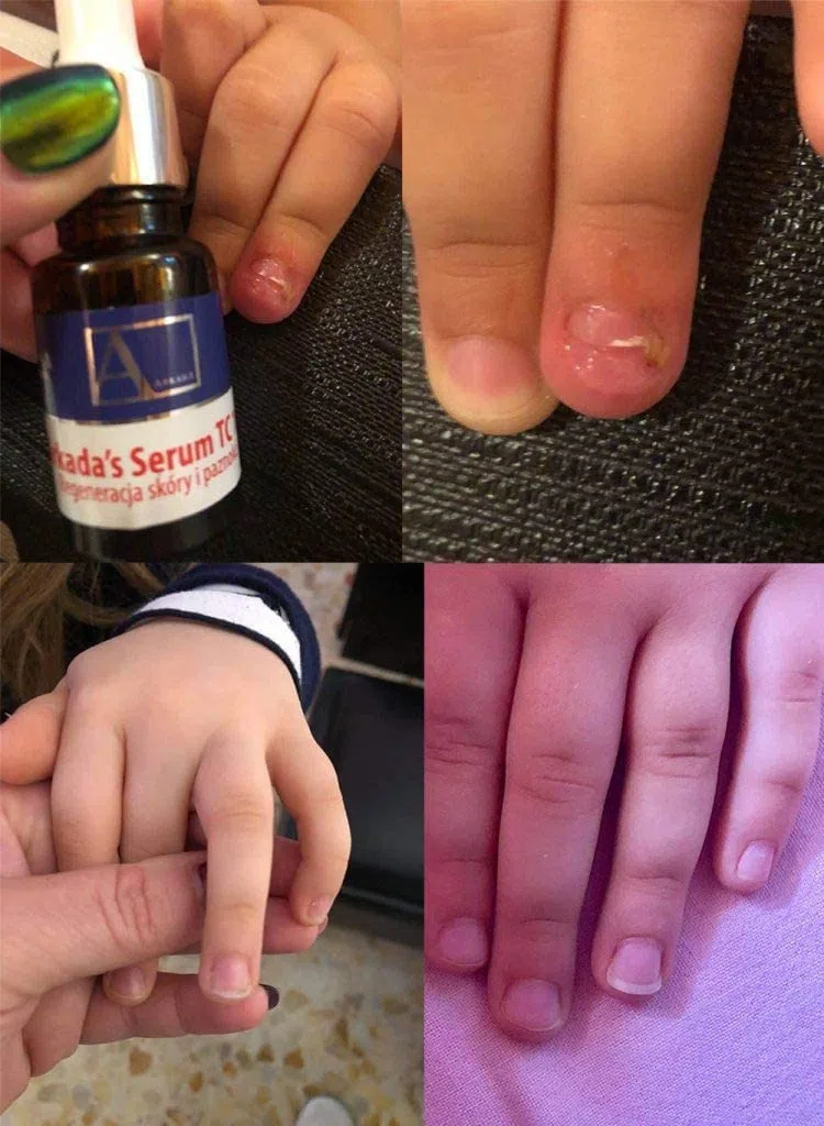 Serum Tc16 Di Arkada Serum Che Ricostruisce La Pelle Problematica E Le Unghie Danneggiate, Trattamento Intenso Al Collagene - 11 Ml