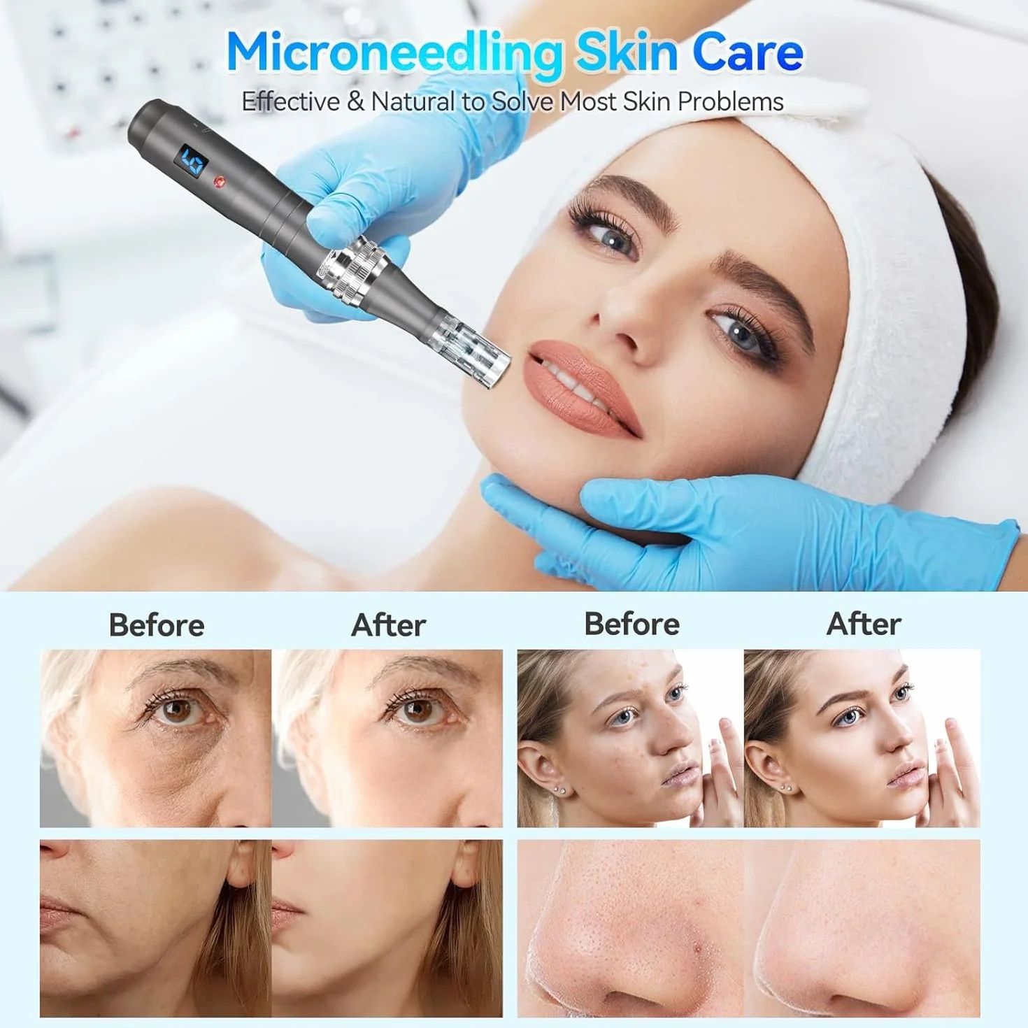 20PCS Dermapen Ultima M8 Microneedling Pen 16 Pins Cartucce di Ricambio Smaltimento Microneedling Viso Cartucce per Penna Microneedling