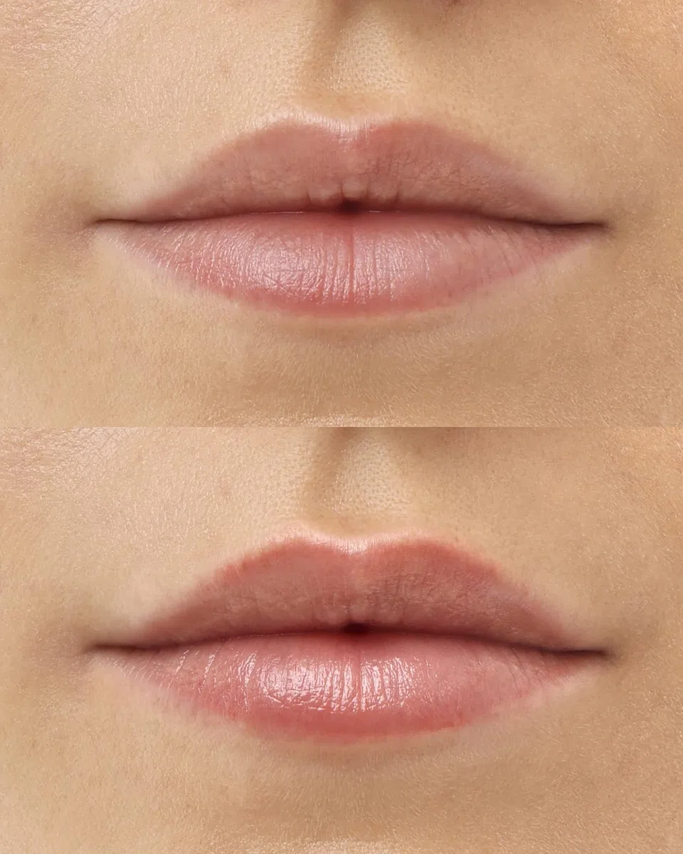 PROJECT LIP - Primer rimpolpante opaco estremo