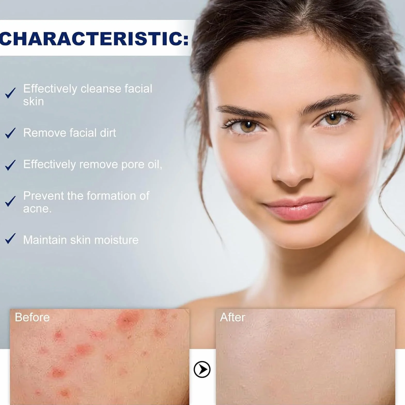 Acne Foaming Wash, Lozione detergente viso e corpo,Schiuma detergente per acne,Detergente viso morbido per la pulizia dei pori profondi