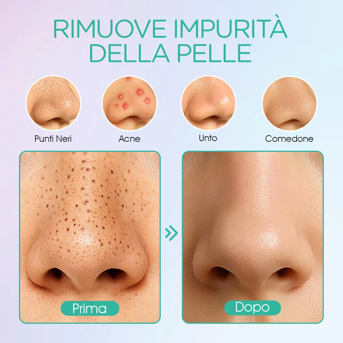 VOYOR Aspiratore Punti Neri 6-In-1 Aspira Rimozione di Elettrico Comedone Estrattore Pulizia Viso Tramite Ricaricabile per Uomini e Donne BR410
