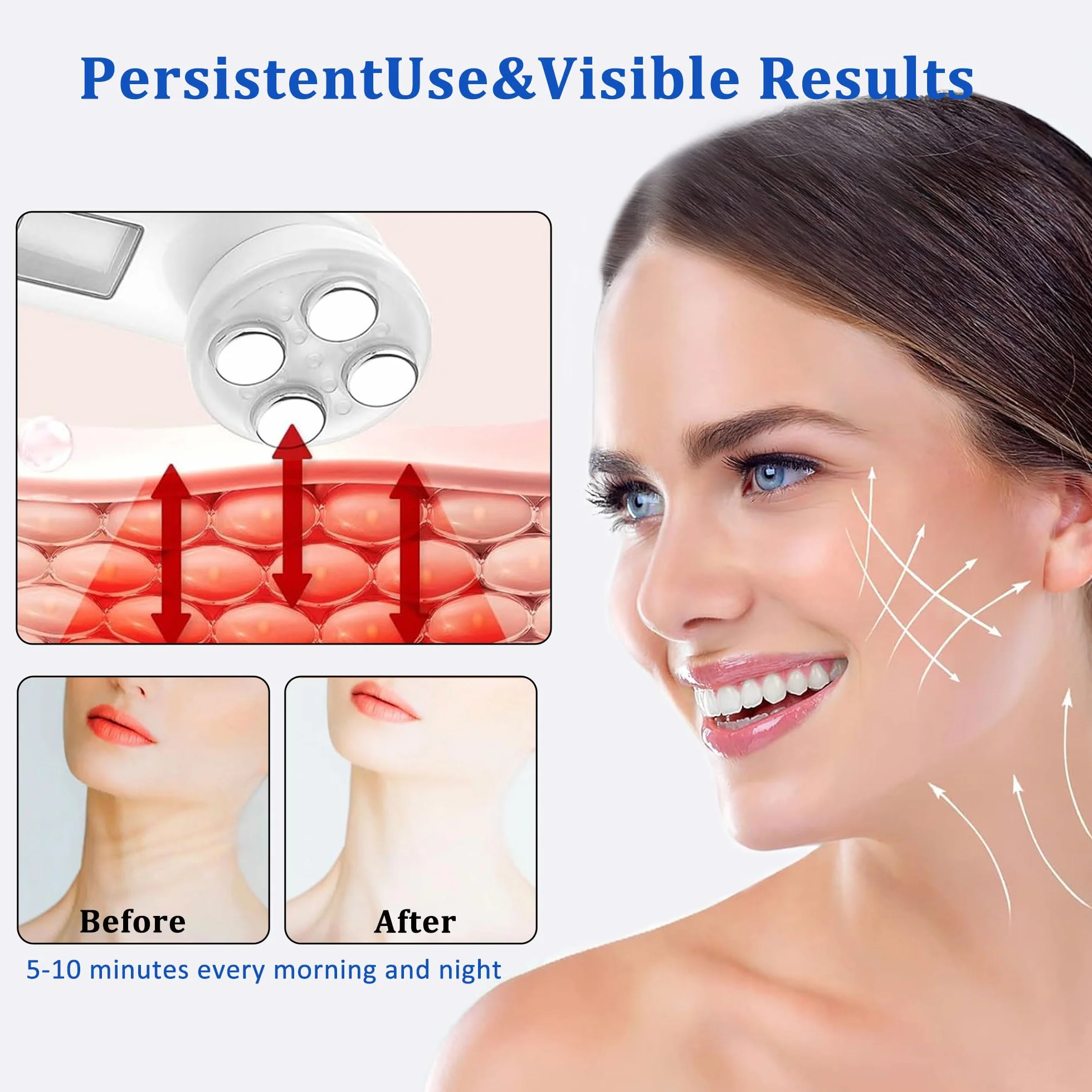 AILEDA Elettrico Massaggiatore Viso,il Lifting e il Rassodamento Della Pelle Cadente,Ultrasuoni Terapia LED Radiofrequenza Viso e Corpo Massaggiatore Viso Antirughe,Della Pelle Cura del Quotidiana