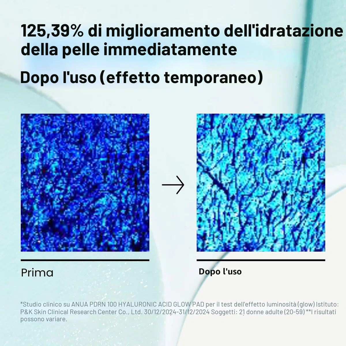 Anua PDRN 100 Hyaluronic Acid Glow Pads - Dischetti tonico viso coreani glow e rimpolpanti con PDRN e Acido Ialuronico, idratazione profonda, prep make-up, doppia texture (180 ml, 60 pads)