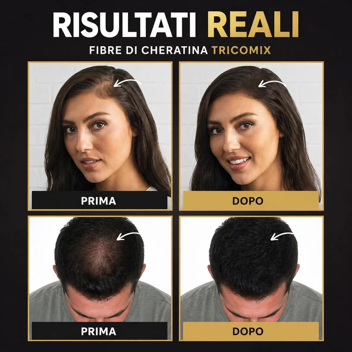 Hair Applicator per Fibre di Cheratina – Applicatore Spray di Precisione per Fibre Capelli, Distribuzione Uniforme e Naturale, Compatibile con Flaconi TRICOMIX