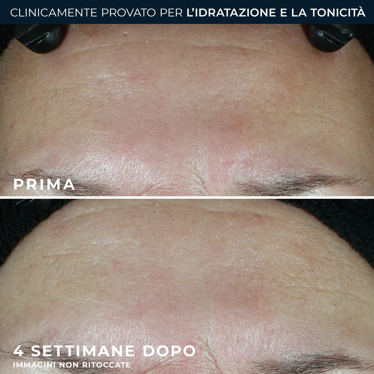 RoC - Multi Correxion Hydrate + Plump Moisturizer SPF30 - Trattamento Antirughe - Protezione Dai Raggi UVA/UVB B - 50ML
