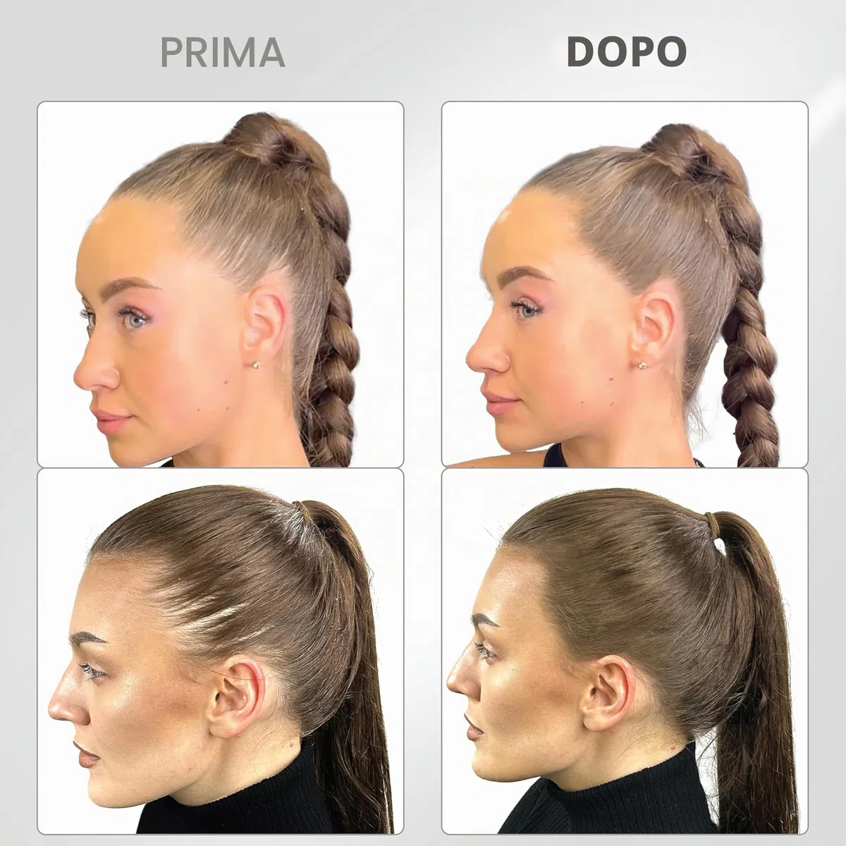 Thick Fiber Polvere per ritocchi radici, castano medio, set di correttori per la caduta dei capelli impermeabili e anti-sudore, con pennello copertura attaccature sottili e radici grigie