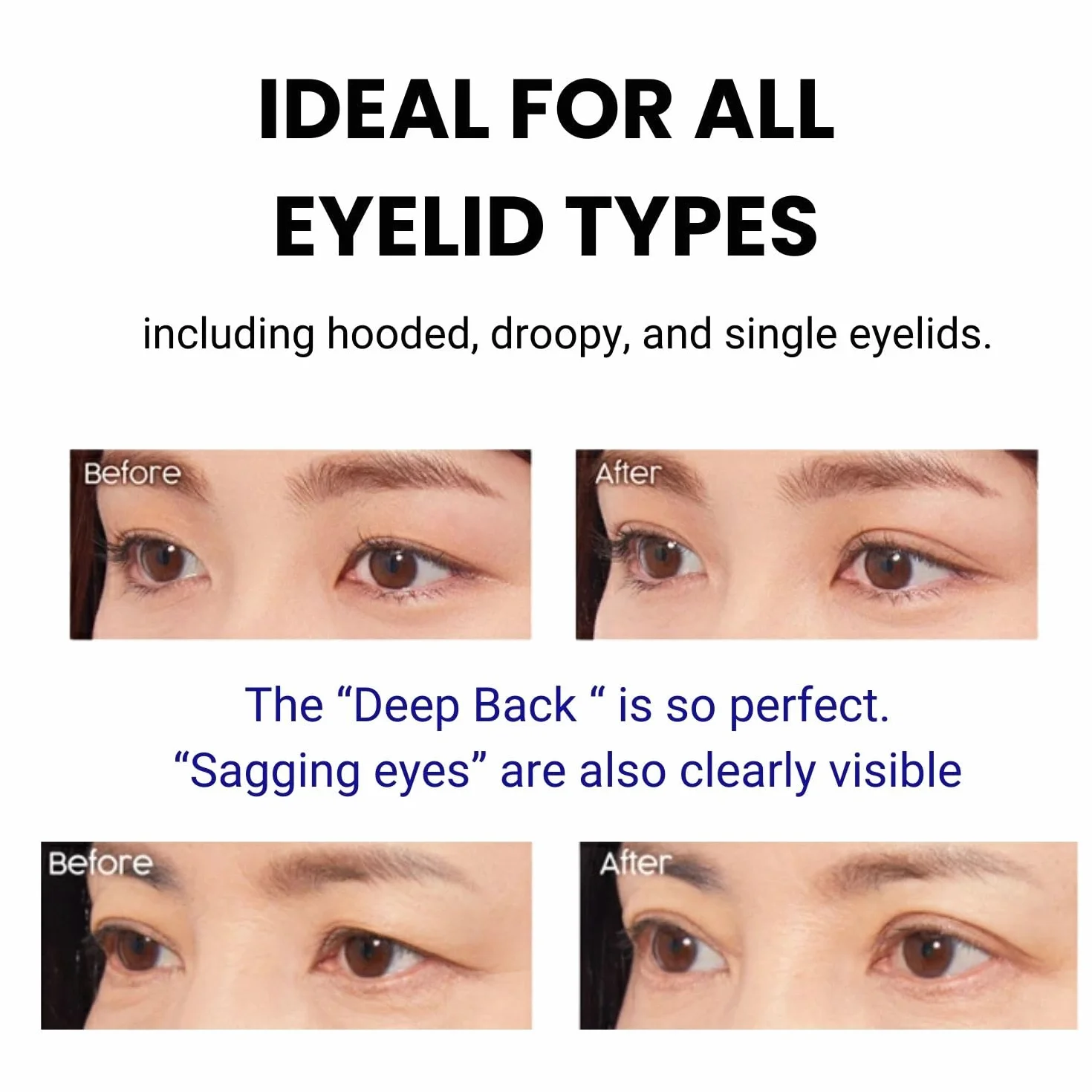 D.U.P Wonder Eyelid Tape Extra - 120 pcs