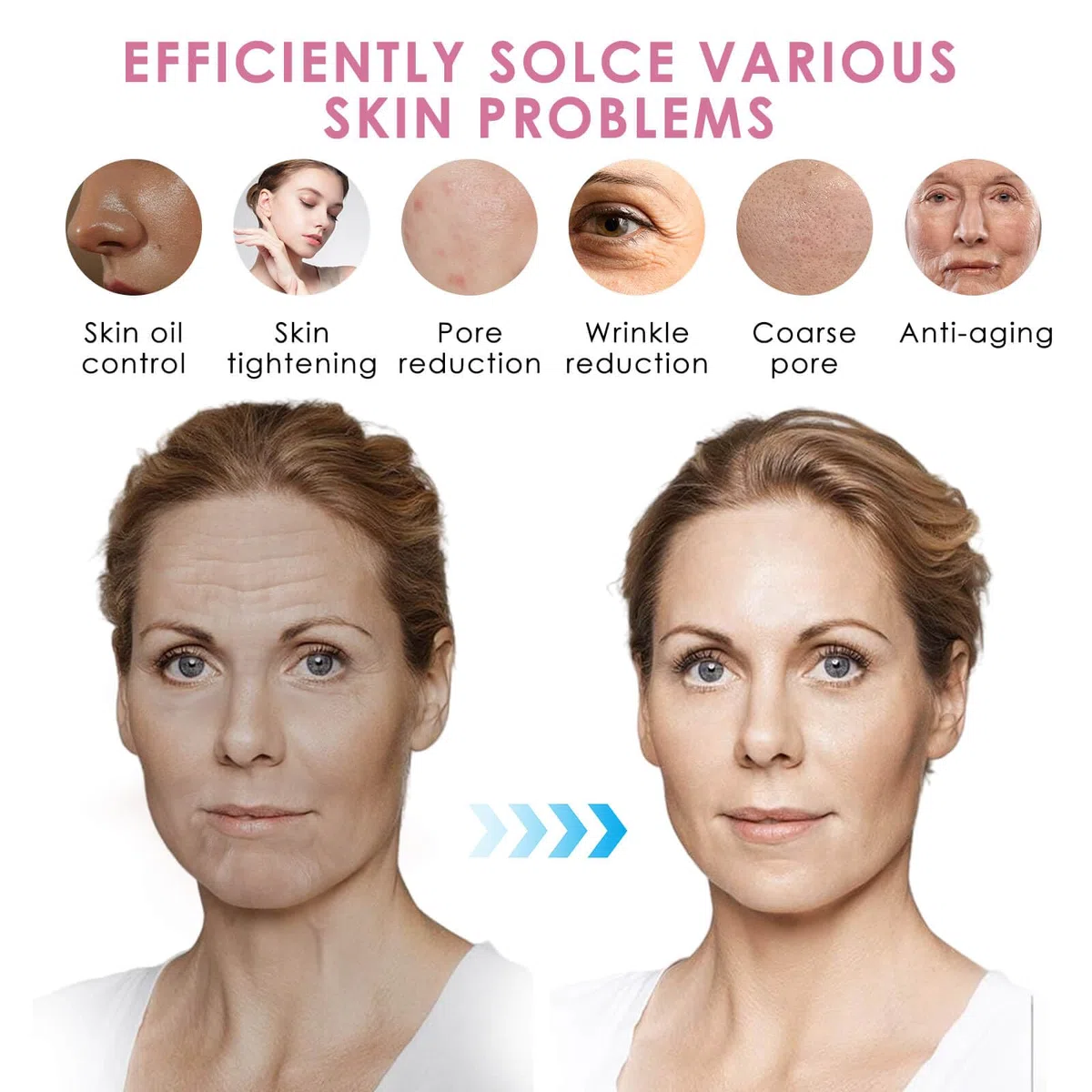 Nano R Cartucce di ricambio per Dr. Pen M5 M7 N2 E30 – Monouso Nano Beauty Tips, cartucce igieniche usa e getta per contatto delicato e uniforme, compatibili con Dr. Pen M5 M7 N2 E30 (15 pezzi)