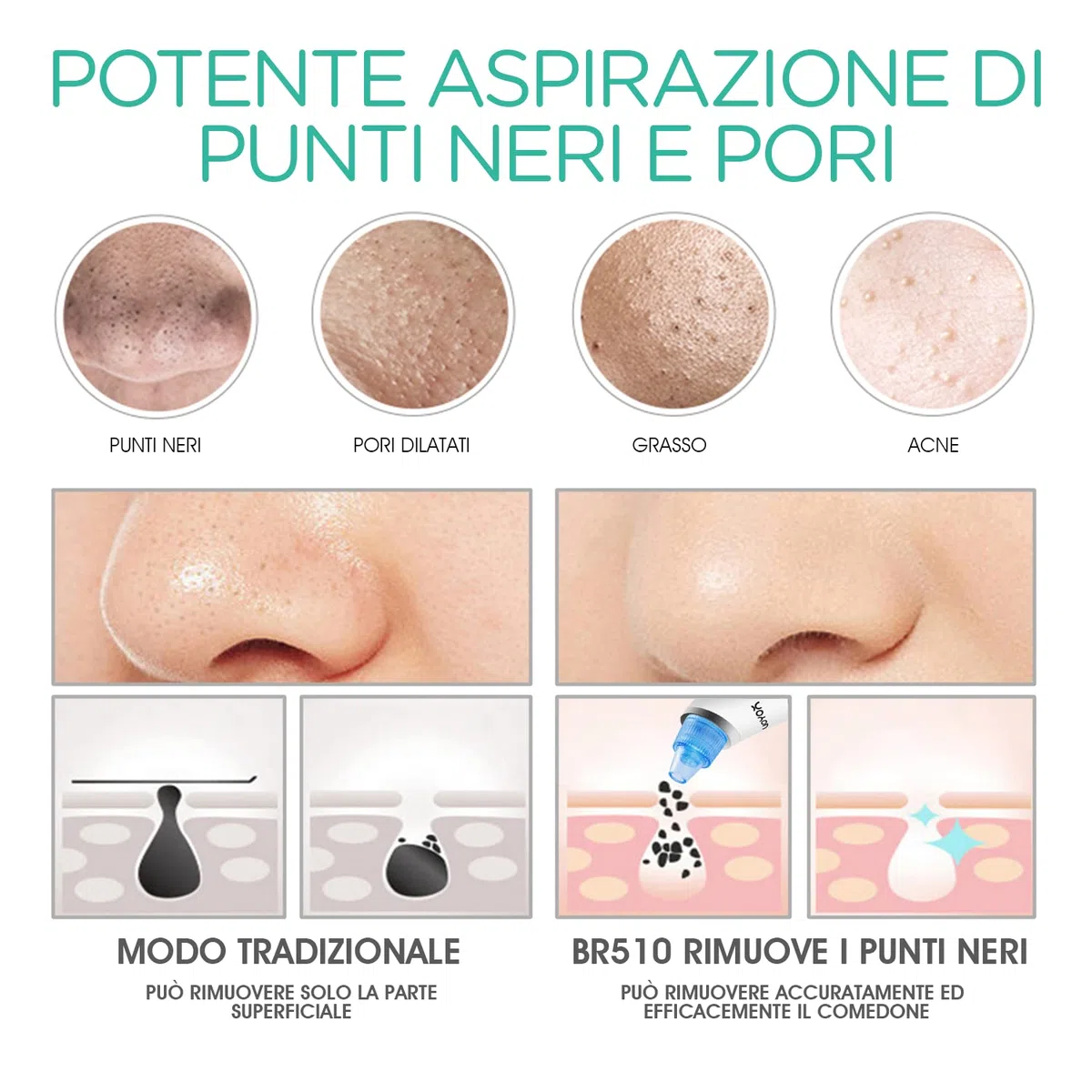 VOYOR Aspirapolvere punto nero professionale 6 in 1 estrattore di punti nero elettrico pneumatico comedoni acne detergente per pori cura viso donna, 6 sonde e 5 modalità, ricaricabile con display LCD