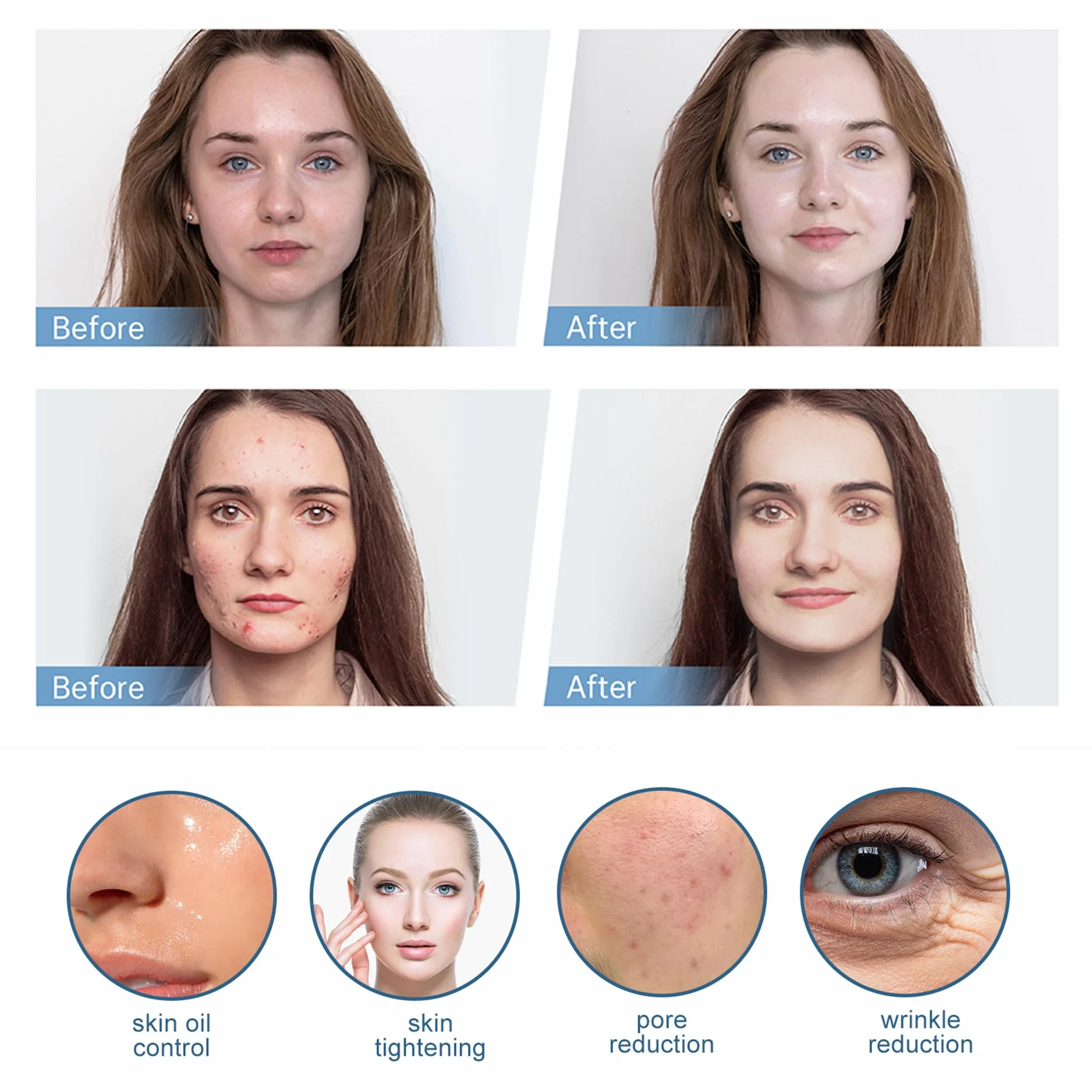 30 Cartucce di Ricambio per Penna Microneedling a 12 Aghi per Hydra Pen H3 Applicatore di Siero, Autentiche Punte di Ricambio Monouso Accessori per la Cura della Pelle