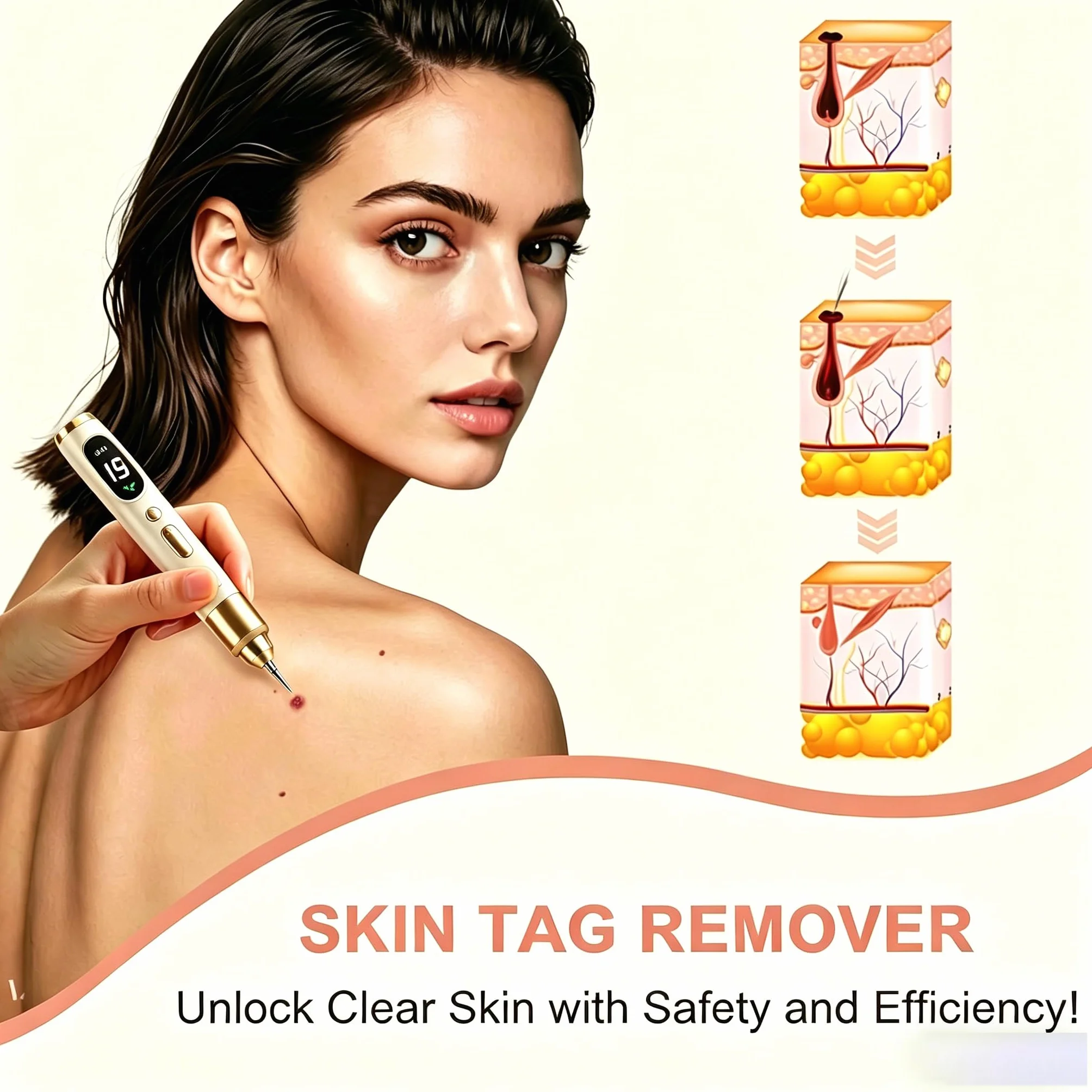 Penna per la rimozione di porri, Rimuove Voglie Verruche Skin Tag Remover con 19 Livelli Regolabili e Luce LED per Nei, Verruche, Lentiggini, Macchie Scure