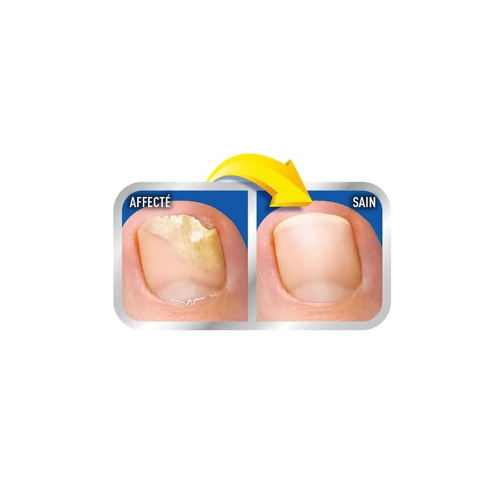 Scholl - Soluzione per unghie Mycoses, 3,8 ml