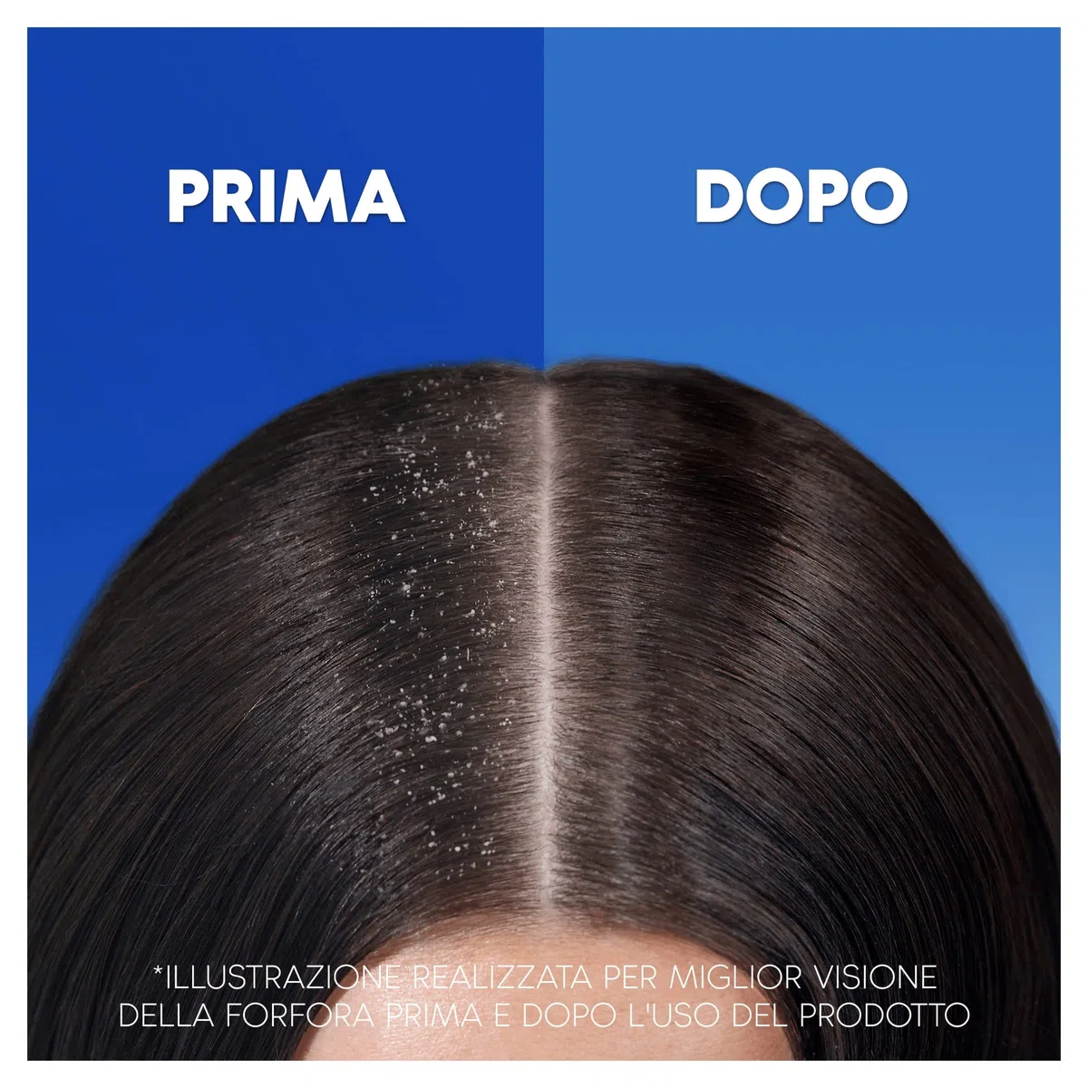 Head & Shoulders Antiforfora Shampoo e Balsamo 2in1, Anticaduta Dovuta A Rottura, Fino Protezione dalla Forfora per Cute e Capelli, Con Microbioma Bilanciato, 225 ml x6