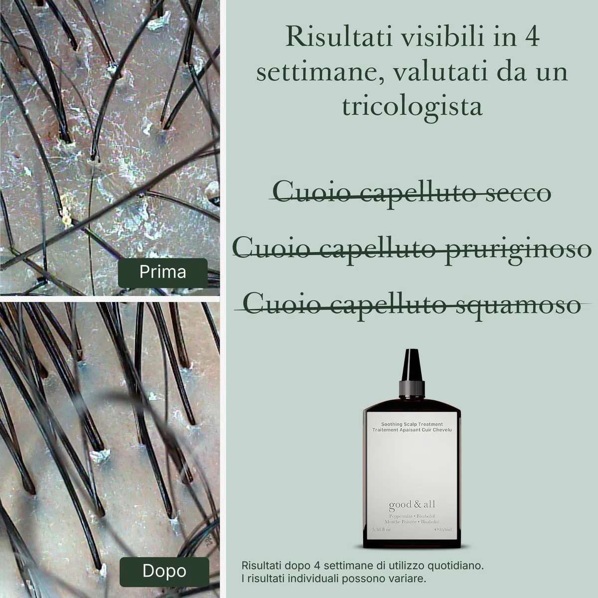 Good&All Trattamento Anti Prurito per il Cuoio Capelluto Secco e Sensible - Senza Risciacquo, senza Profumo, Vegano - 165ml