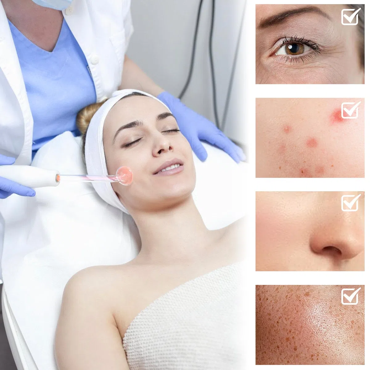 Barra ad alta frequenza viso con 4 sonde, macchina per il viso di bellezza, parete ad alta frequenza, dispositivo di radiofrequenza viso, macchina per il viso di bellezza, dispositivo per il