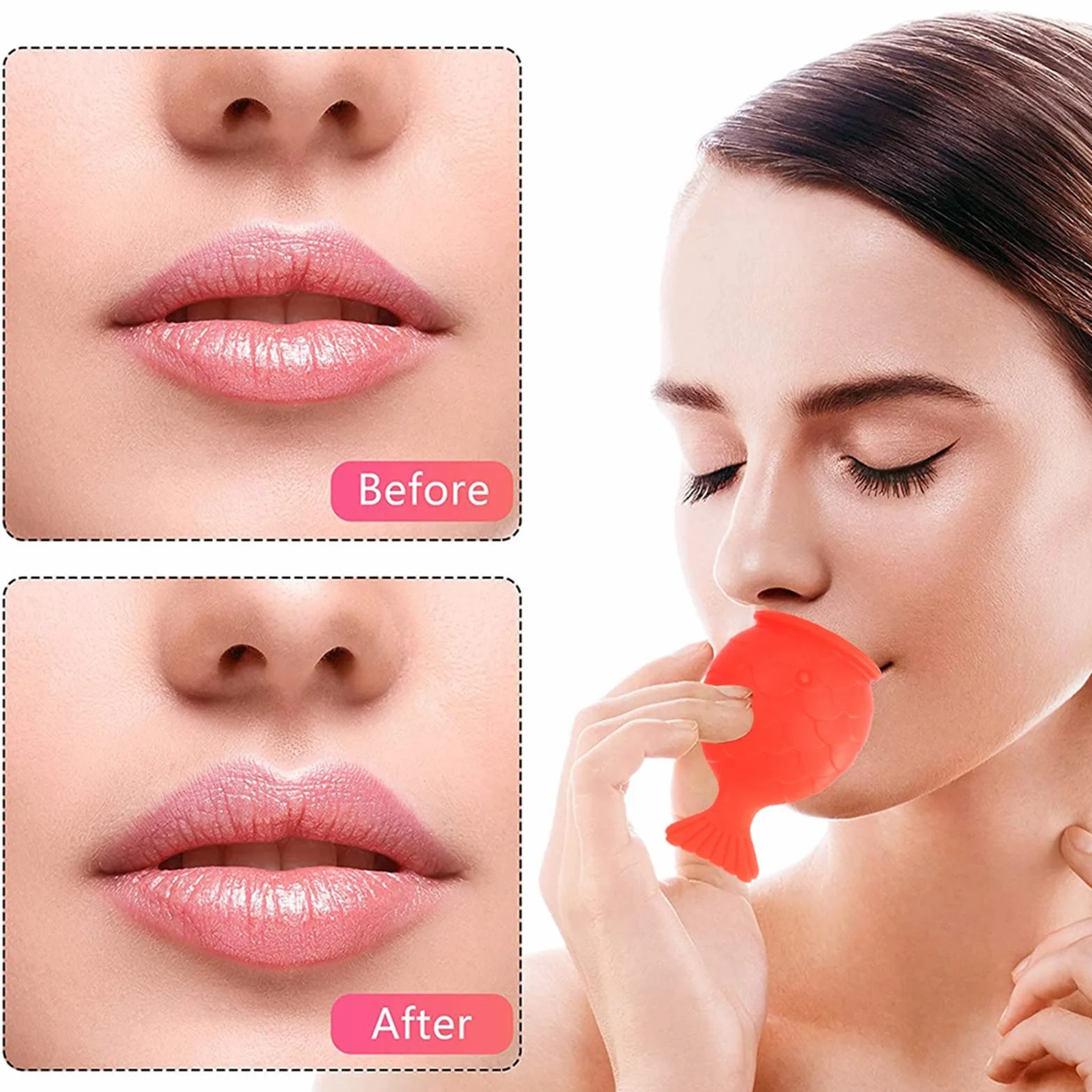 Dispositivo per Plumper per Labbra, Ventose per Labbra Portatili a Forma di Pesce, Dispositivo per il Miglioramento delle Labbra, Strumento di Bellezza per Tutti i Giorni per Avere un Labbro Sexy