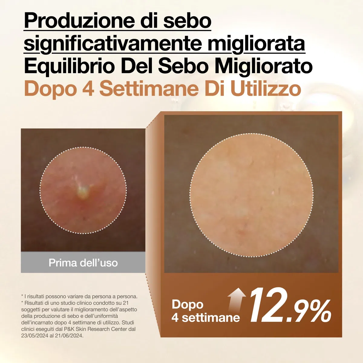 Anua Rice 70 Glow Milky Toner – Tonico Viso Idratante e Illuminante Coreano, con Acqua di Riso 70%, Niacinamide, Ceramidi e Pantenolo, Tonico Lattiginoso per Pelle Sensibile, Non Comedogenico (250ml)