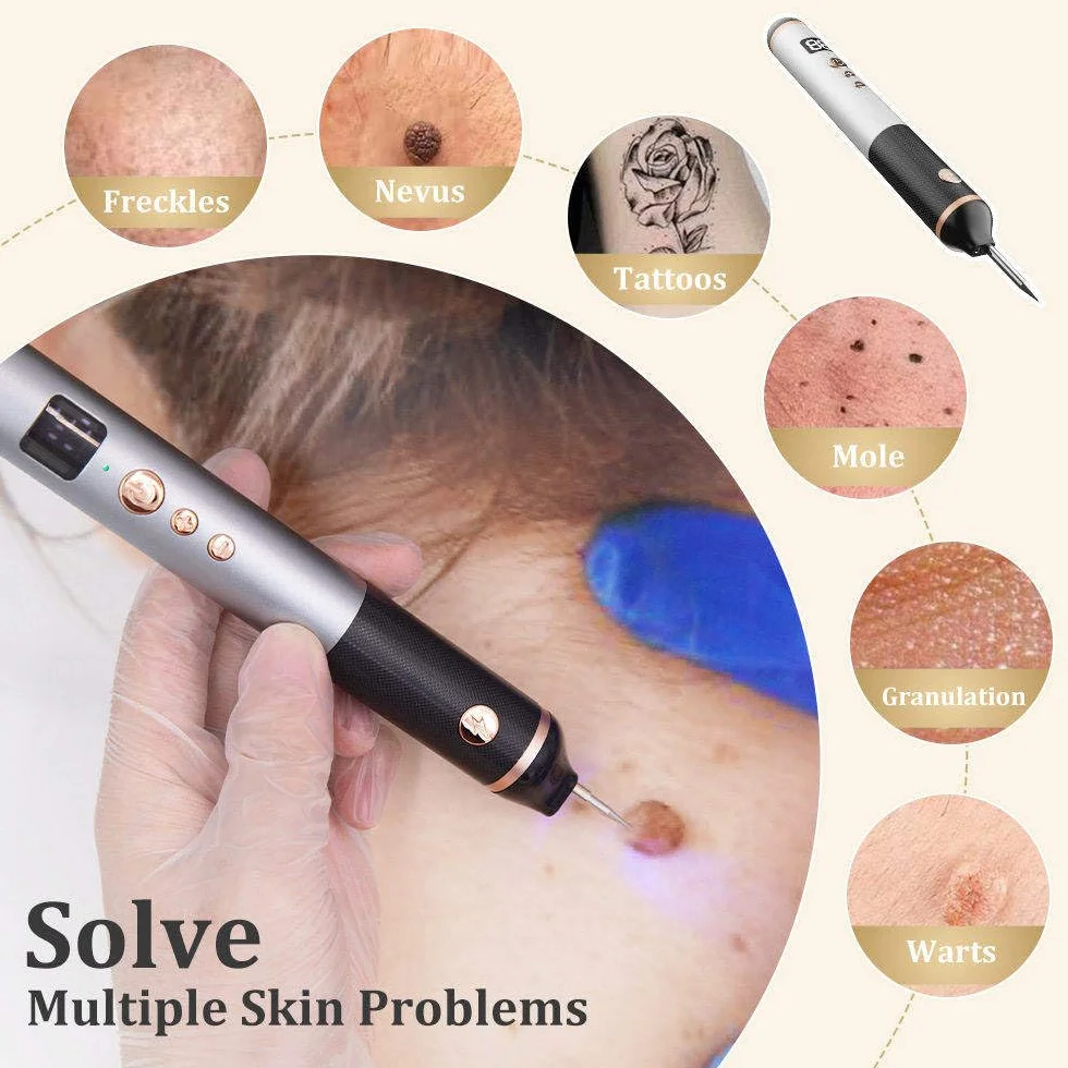 Penna Laser al Plasma a 15 Livelli, Penna per La Rimozione di Verruche, nei, Macchie, Lentiggini, nei, per Labbra, Mani, Occhi, Viso, Testa, Naso, Sicura E Indolore, Non Danneggia La Pelle